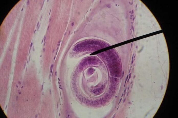 trihineloza